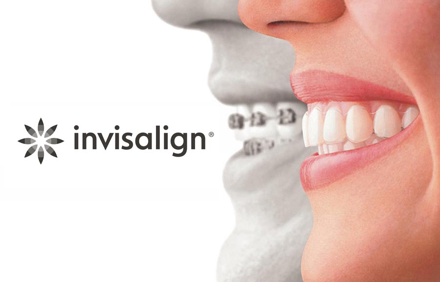 Invisalign Clear Aligners, Mairead M. O'Reilly, DDS, MS