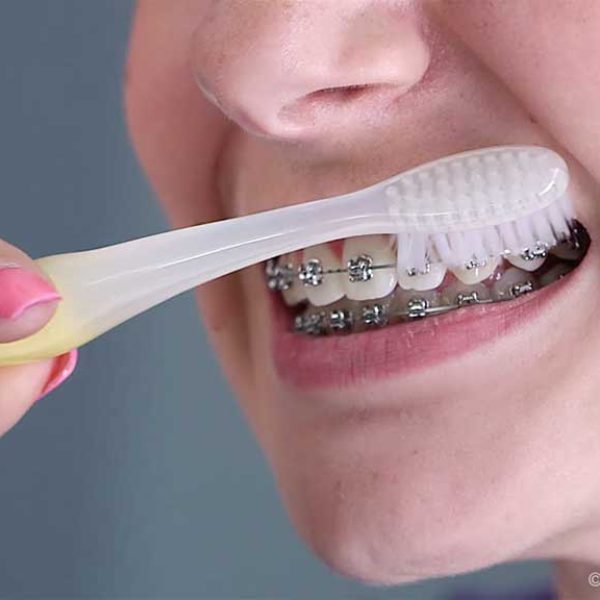 brushing-with-braces